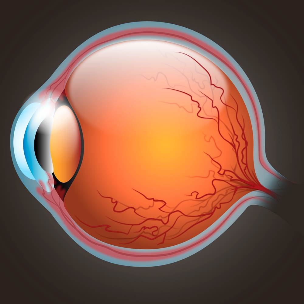 Glaukome in der Augenklinik Zürich behandeln lassen